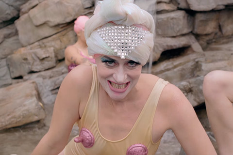 Peaches - Vaginoplasty